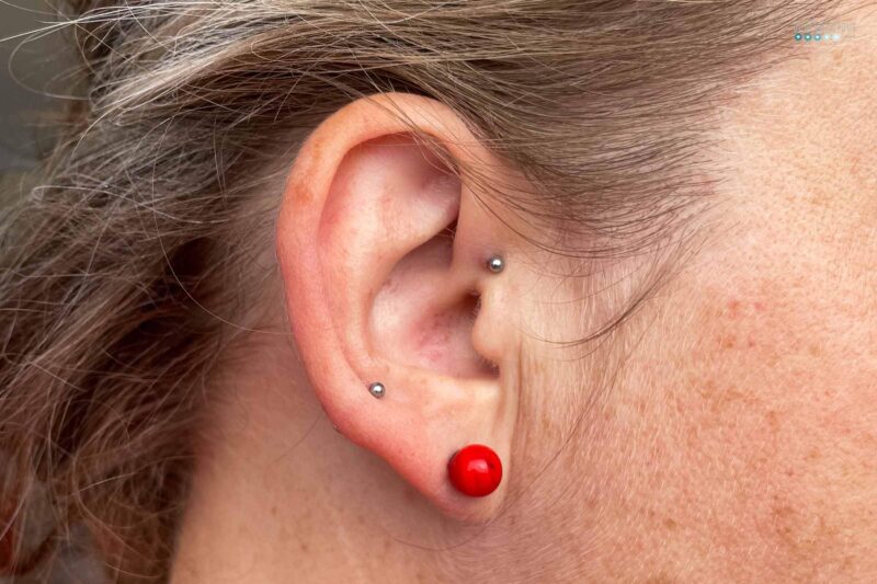 Accupuncture piering