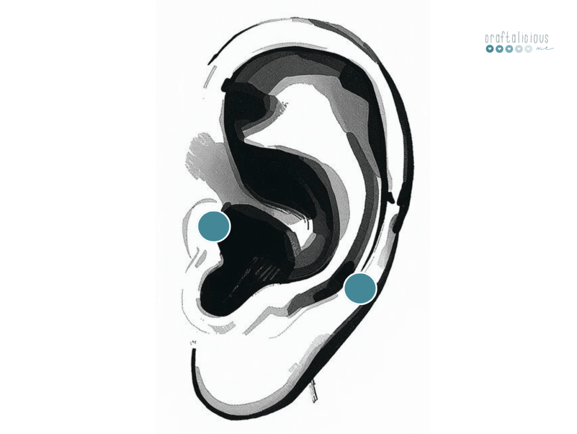 Migraine and sleep piercing acupuncture ear